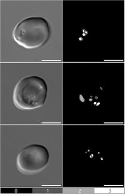 Automating Pitted Red Blood Cell Counts Using Deep Neural Network Analysis: A New Method for Measuring Splenic Function in Sickle Cell Anaemia